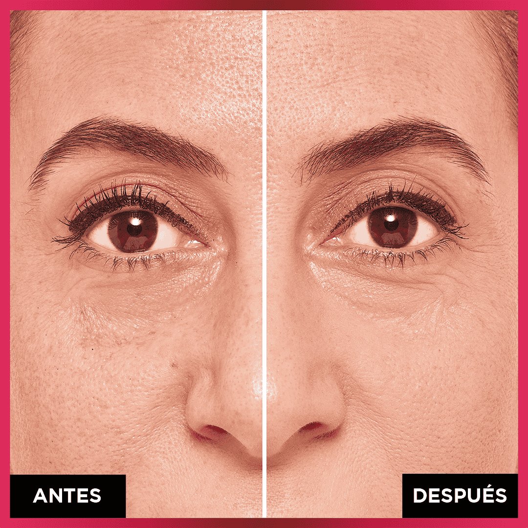 Antes y después: más cobertura